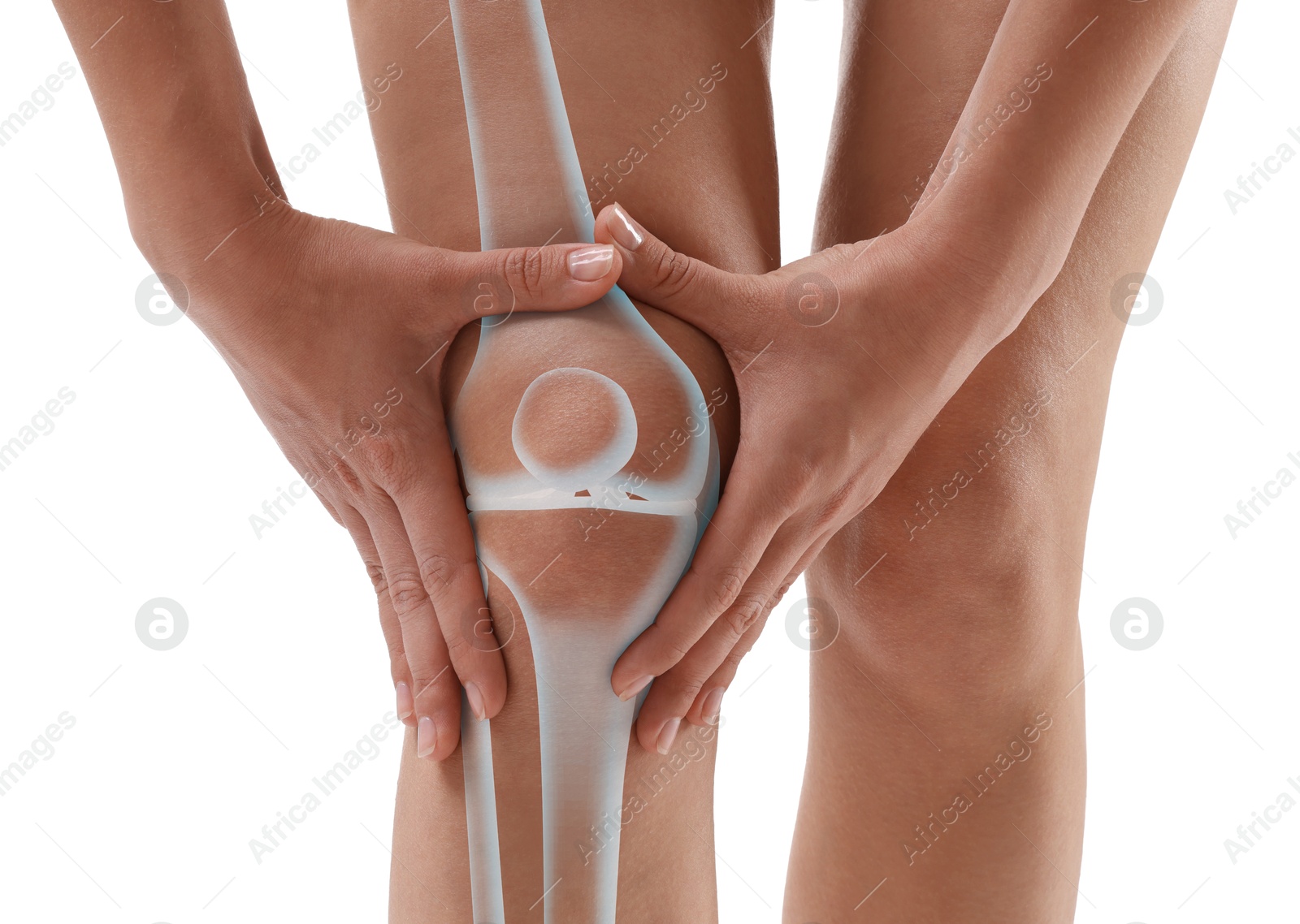 Anatomy of knee. Woman with illustration on her leg against white background, closeup Image of Anatomy of knee. Woman with illustration on her leg against white background, closeup