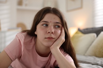 Photo of Upset teenage girl on bed at home