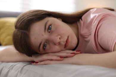 Photo of Depressed teenage girl on bed at home