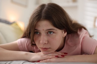 Photo of Depressed teenage girl on bed at home