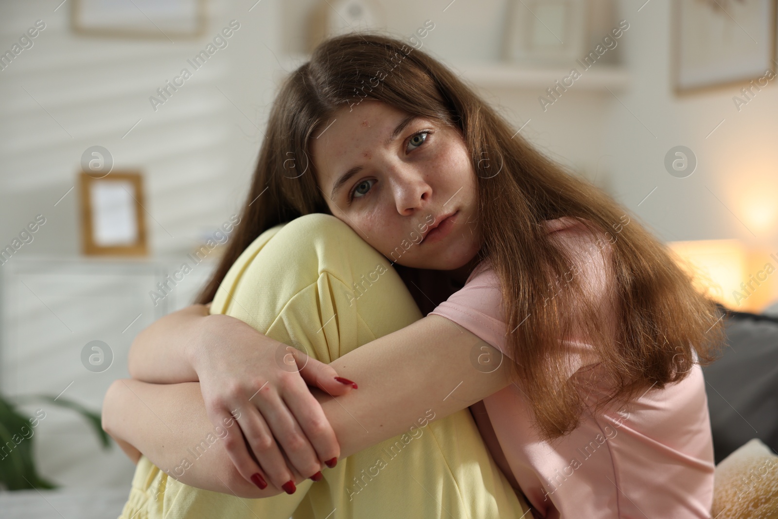 Depressed teenage girl on bed at home Photo of Depressed teenage girl on bed at home