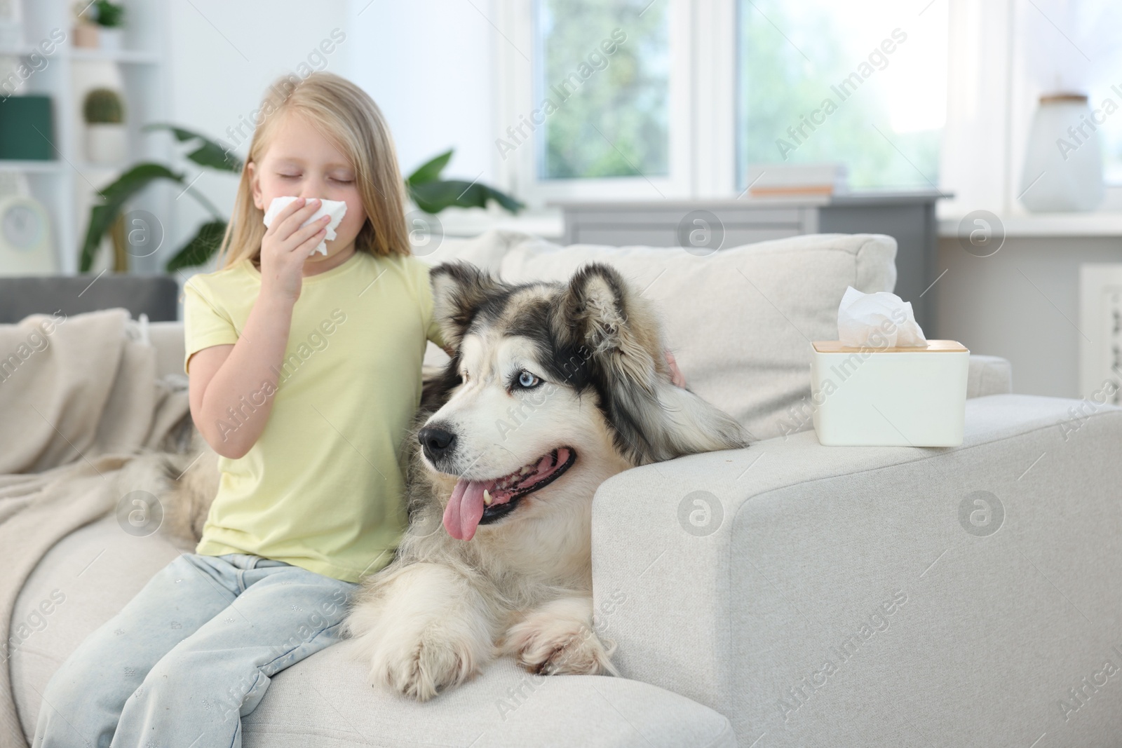 Girl suffering from allergy with her dog at home Photo of Girl suffering from allergy with her dog at home