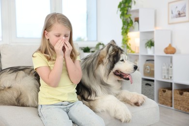 Photo of Girl suffering from allergy with her dog at home