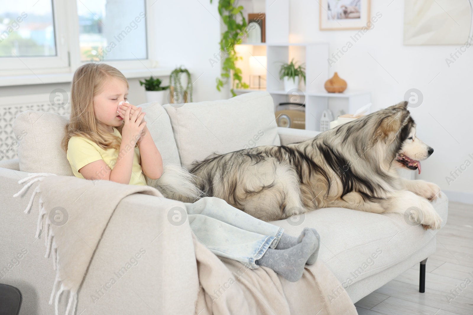Girl suffering from allergy with her dog at home Photo of Girl suffering from allergy with her dog at home