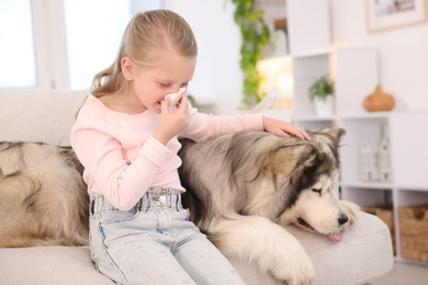 Photo of Girl suffering from allergy with her dog at home