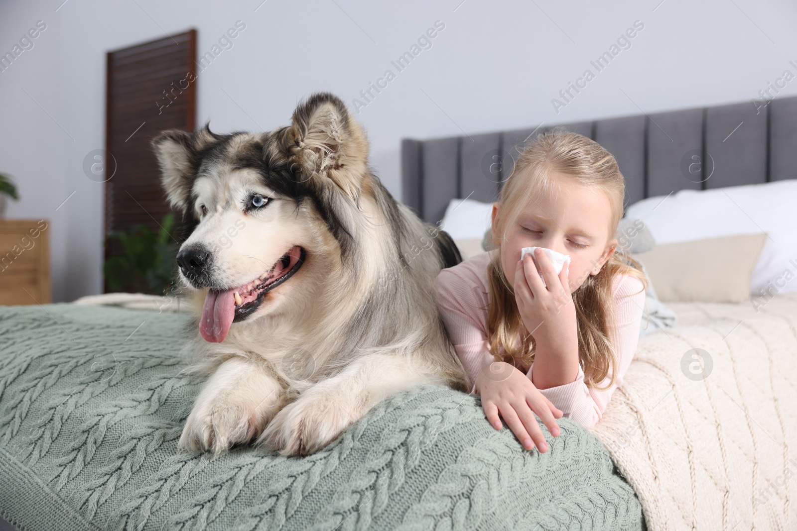 Girl suffering from allergy with her dog on bed at home Photo of Girl suffering from allergy with her dog on bed at home