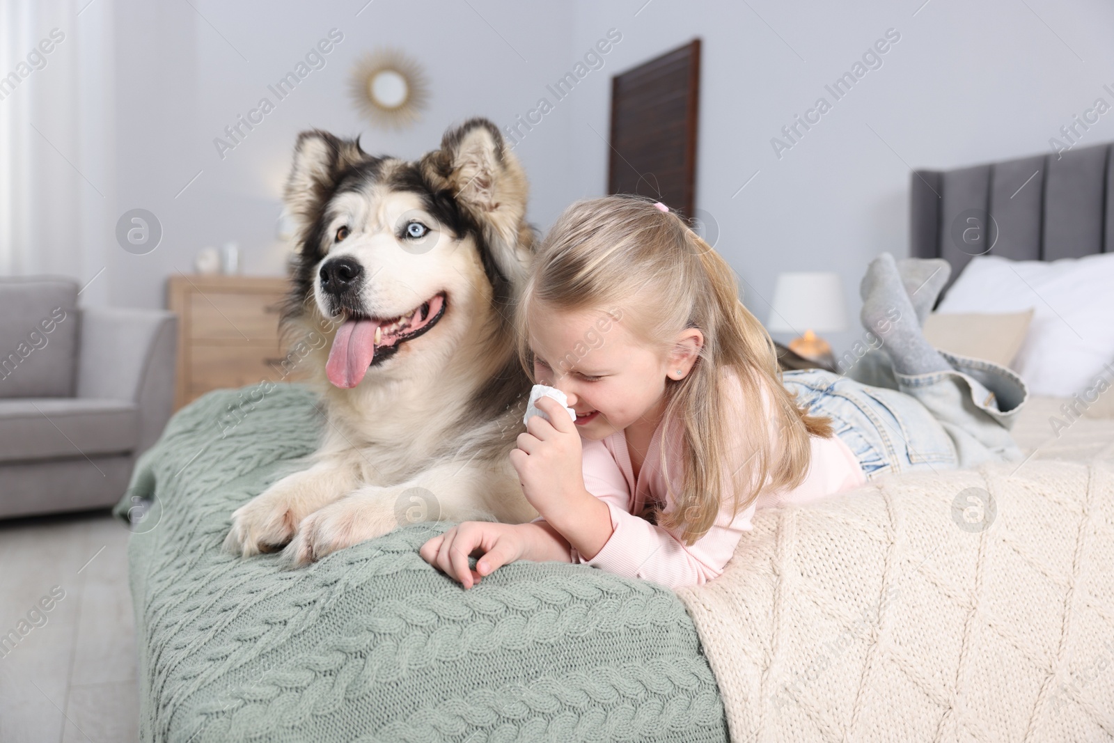 Girl suffering from allergy with her dog on bed at home Photo of Girl suffering from allergy with her dog on bed at home