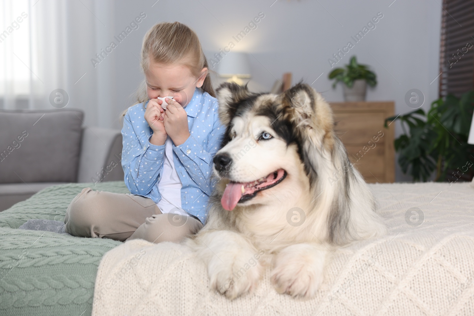 Girl suffering from allergy with her dog on bed at home Photo of Girl suffering from allergy with her dog on bed at home