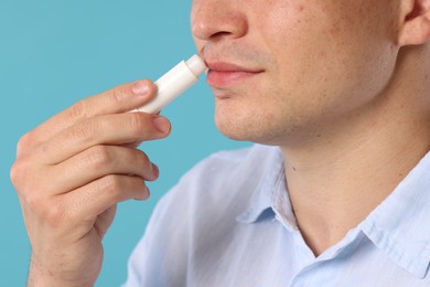 Photo of Young man applying lip balm onto his lips on light blue background, closeup