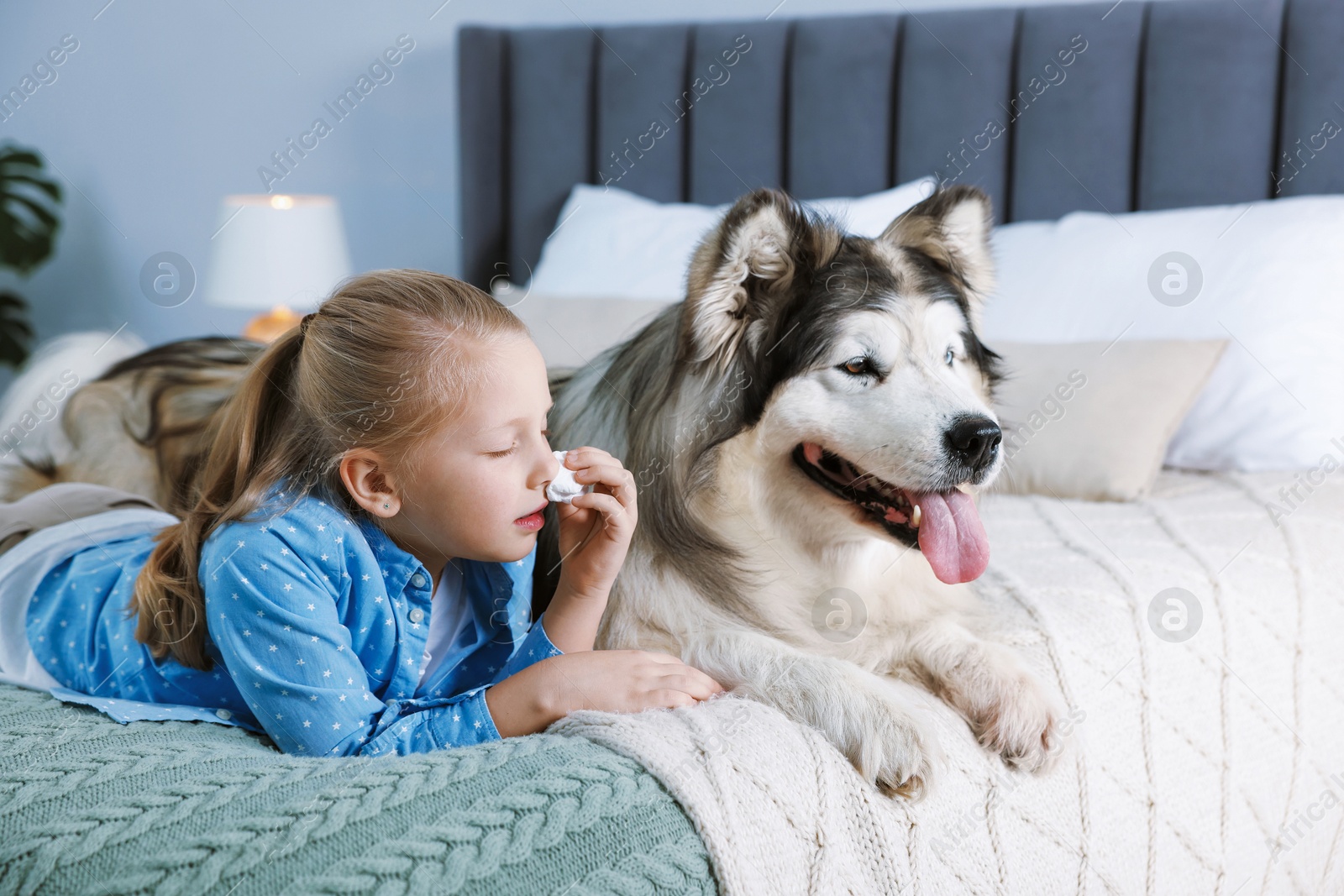Girl suffering from allergy with her dog on bed at home Photo of Girl suffering from allergy with her dog on bed at home