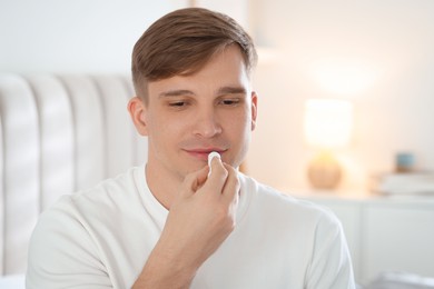 Photo of Young man applying lip balm onto his lips at home