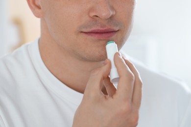 Photo of Young man applying lip balm onto his lips at home, closeup