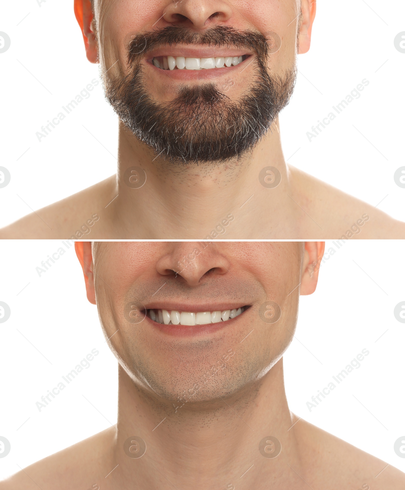 Man before and after shaving on white background, closeup. Collage of photos Image of Man before and after shaving on white background, closeup. Collage of photos