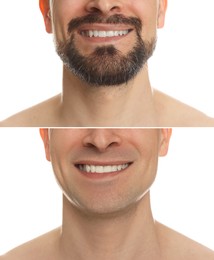 Image of Man before and after shaving on white background, closeup. Collage of photos