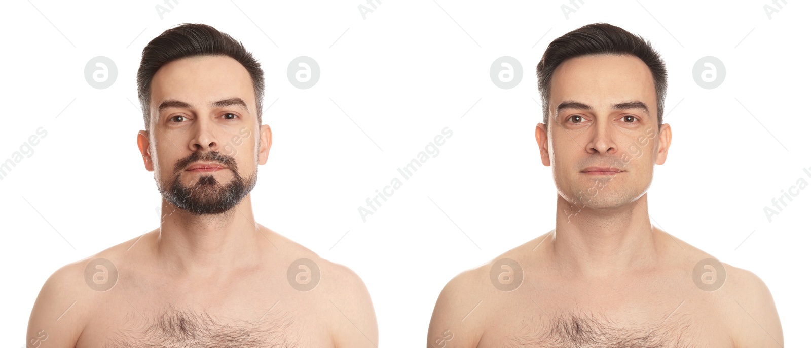 Handsome man before and after shaving on white background, collage of photos Image of Handsome man before and after shaving on white background, collage of photos