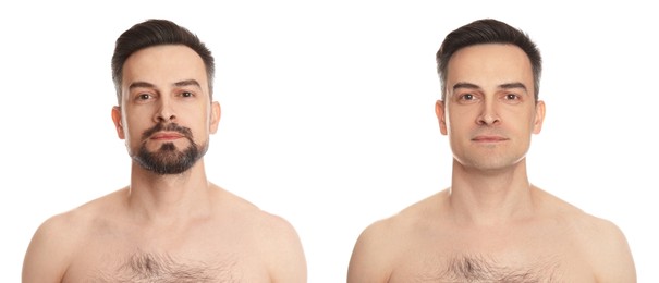 Image of Handsome man before and after shaving on white background, collage of photos