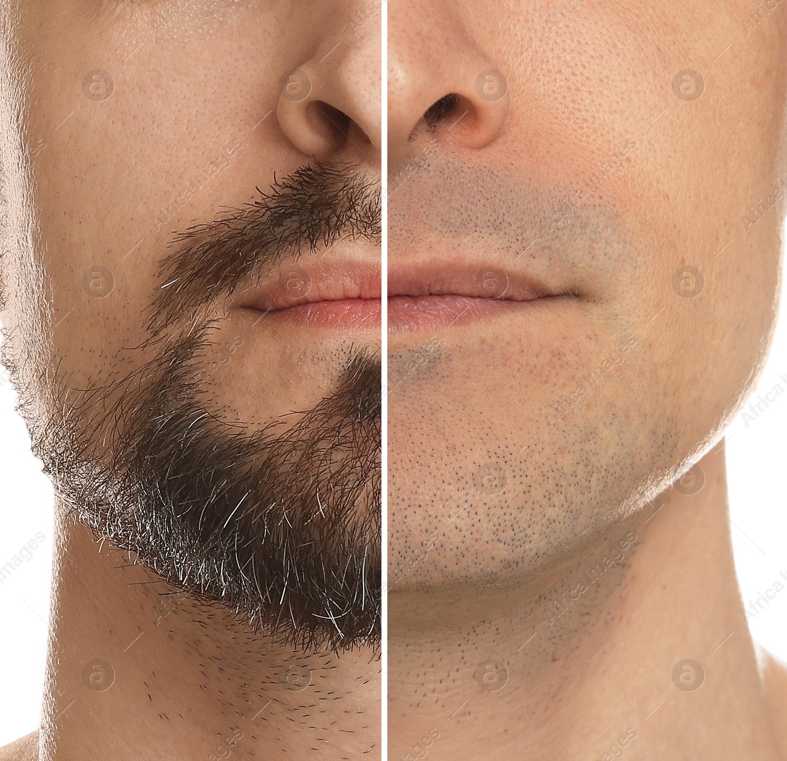 Man before and after shaving on white background, closeup. Collage of photos Image of Man before and after shaving on white background, closeup. Collage of photos