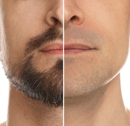Image of Man before and after shaving on white background, closeup. Collage of photos