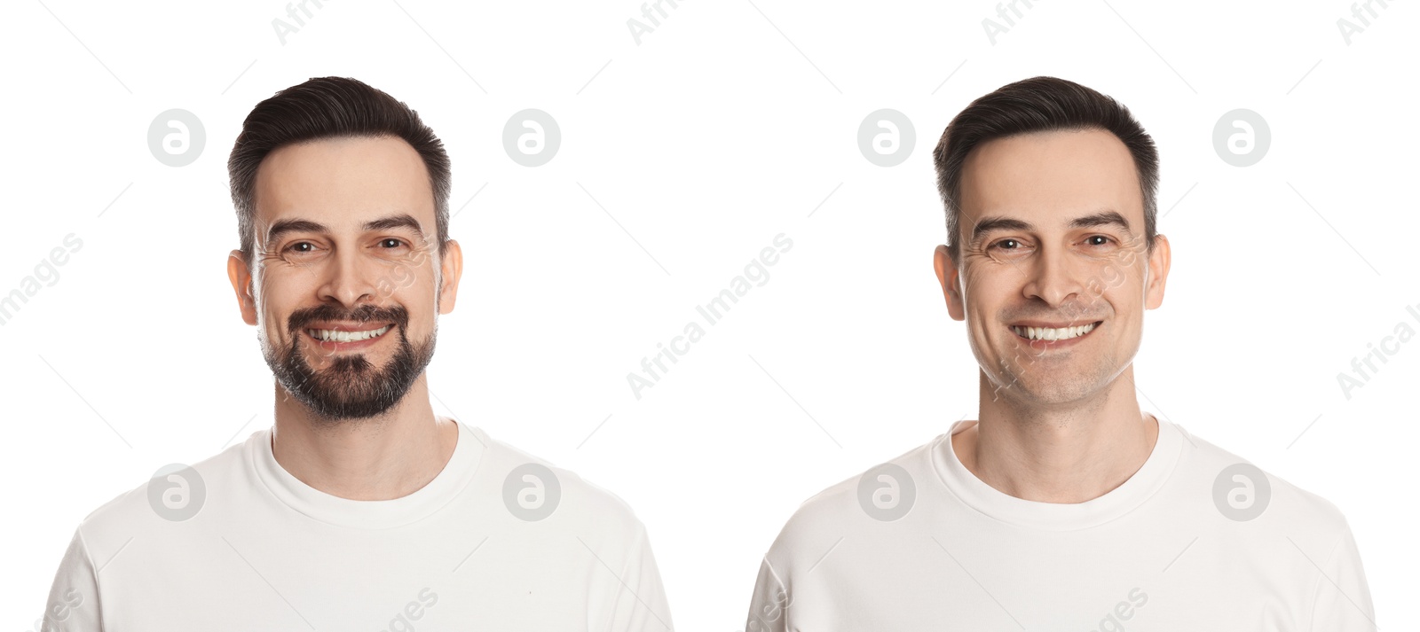 Handsome man before and after shaving on white background, collage of photos Image of Handsome man before and after shaving on white background, collage of photos