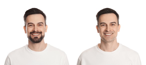 Image of Handsome man before and after shaving on white background, collage of photos
