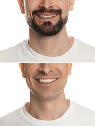 Image of Man before and after shaving on white background, closeup. Collage of photos