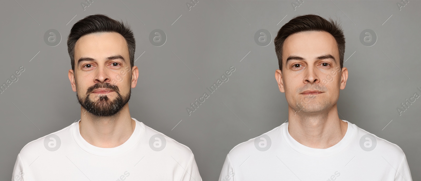 Handsome man before and after shaving on grey background, collage of photos. Banner design Image of Handsome man before and after shaving on grey background, collage of photos. Banner design