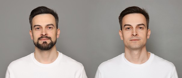 Image of Handsome man before and after shaving on grey background, collage of photos. Banner design