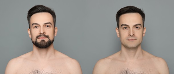 Image of Handsome man before and after shaving on grey background, collage of photos. Banner design