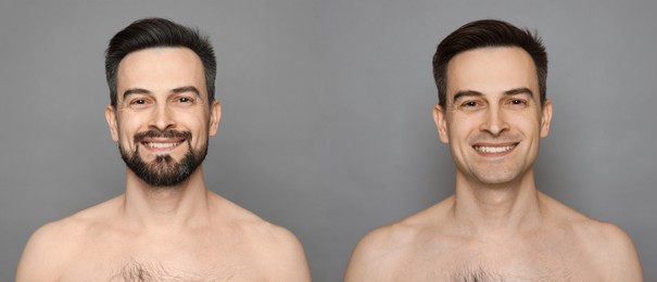 Image of Handsome man before and after shaving on grey background, collage of photos. Banner design