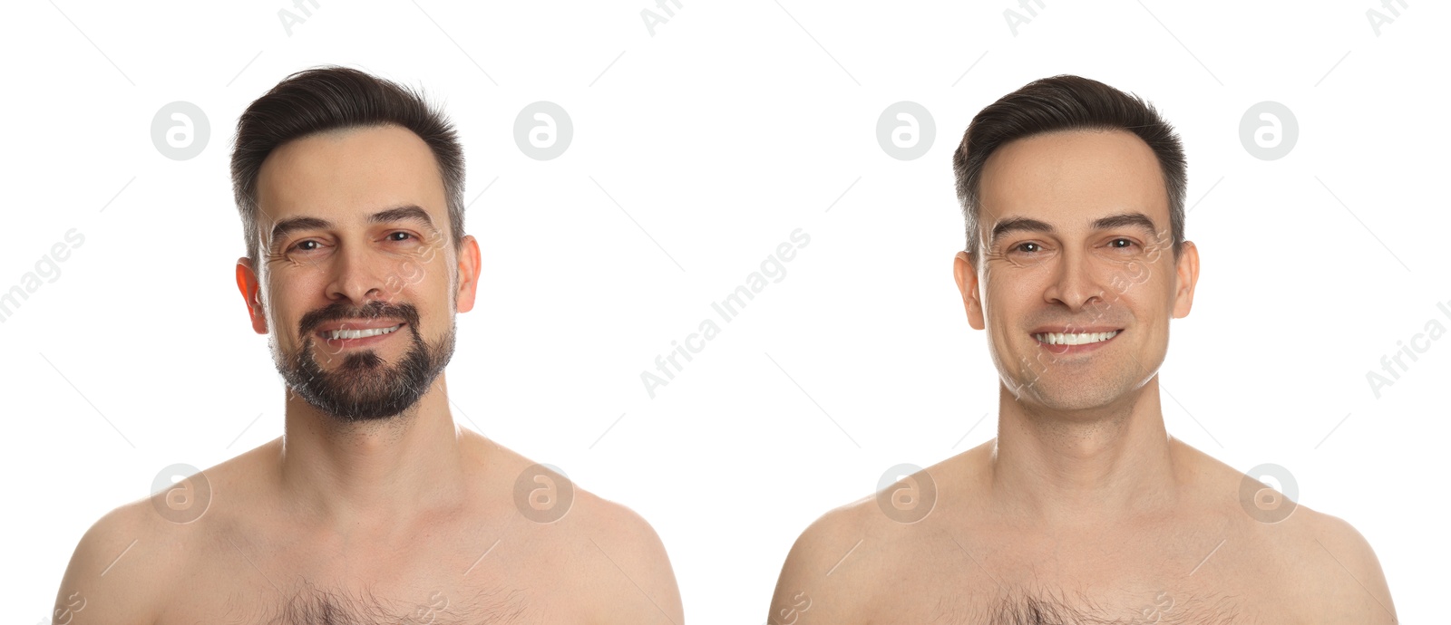 Image of Handsome man before and after shaving on white background, collage of photos