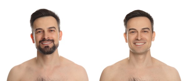 Image of Handsome man before and after shaving on white background, collage of photos
