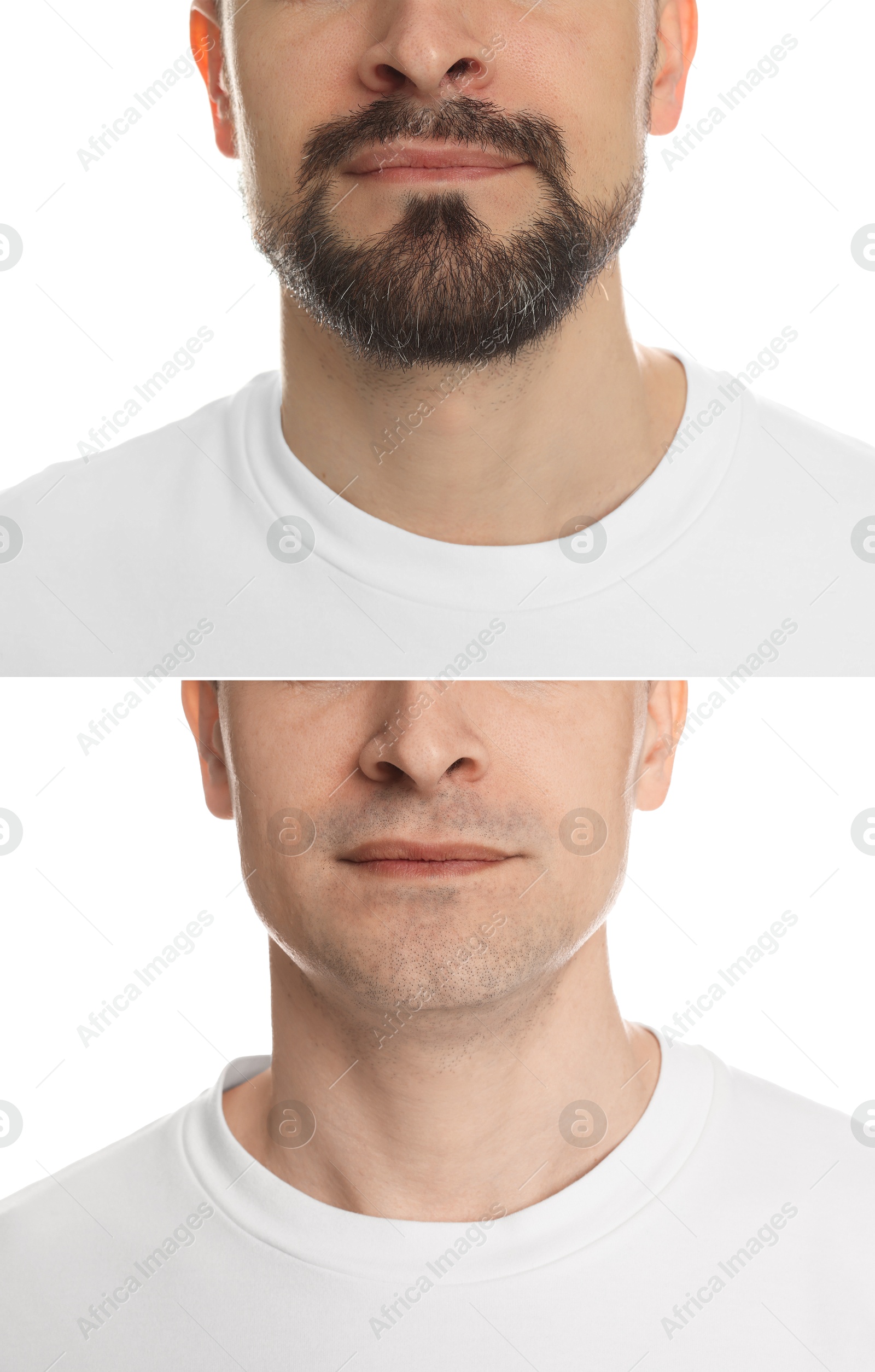 Man before and after shaving on white background, closeup. Collage of photos Image of Man before and after shaving on white background, closeup. Collage of photos