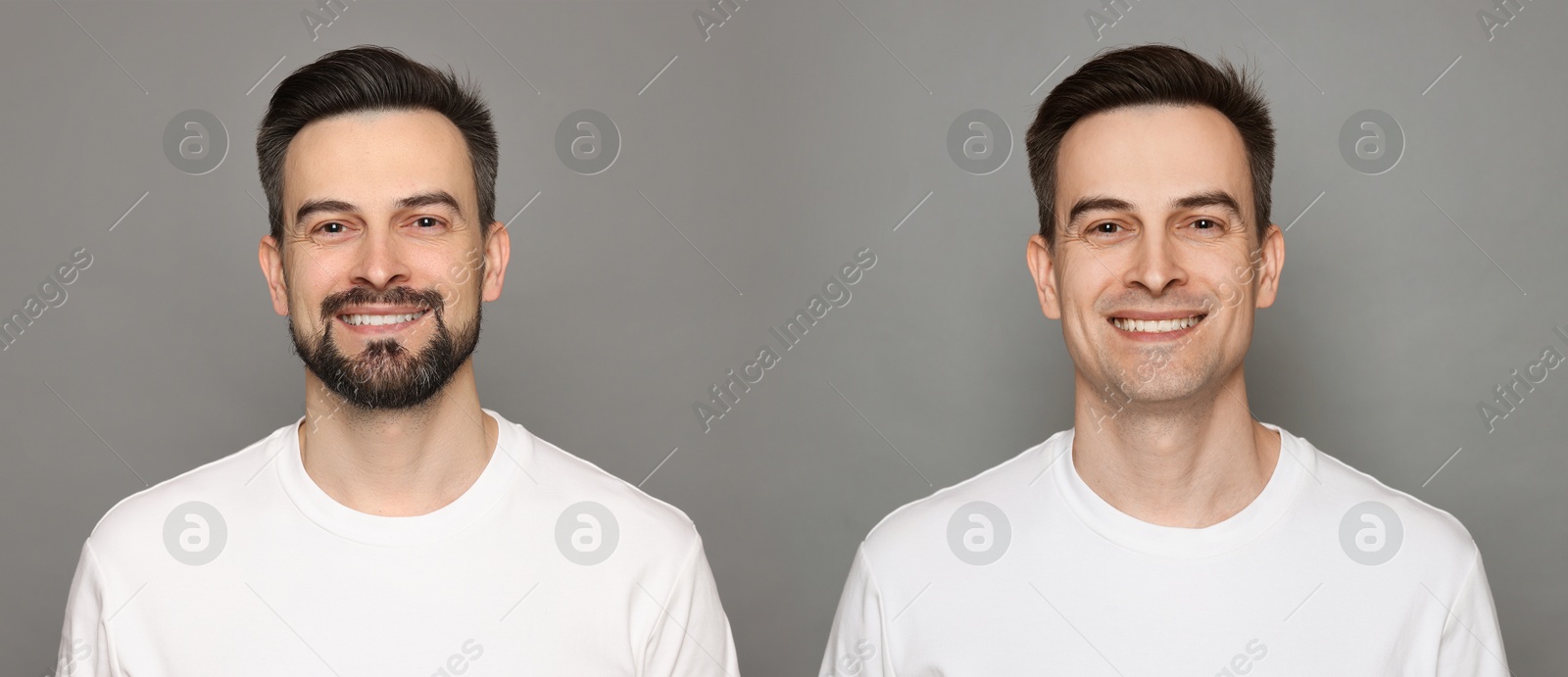 Handsome man before and after shaving on grey background, collage of photos. Banner design Image of Handsome man before and after shaving on grey background, collage of photos. Banner design