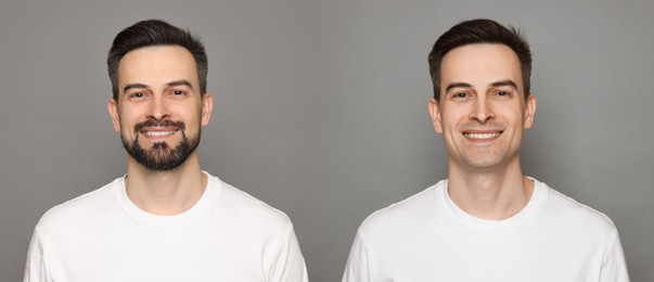 Image of Handsome man before and after shaving on grey background, collage of photos. Banner design