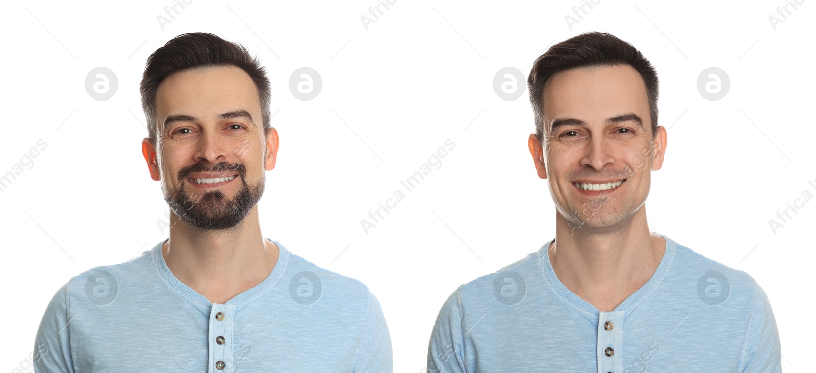 Image of Handsome man before and after shaving on white background, collage of photos