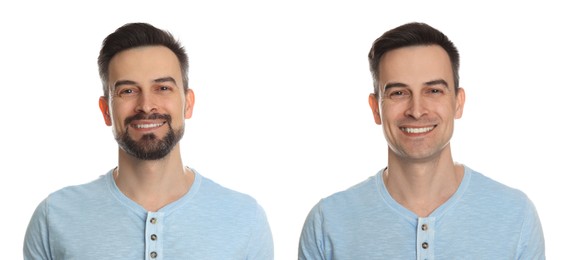 Image of Handsome man before and after shaving on white background, collage of photos
