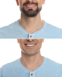 Image of Man before and after shaving on white background, closeup. Collage of photos