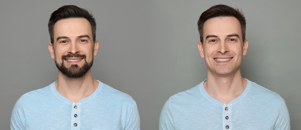 Image of Handsome man before and after shaving on grey background, collage of photos. Banner design