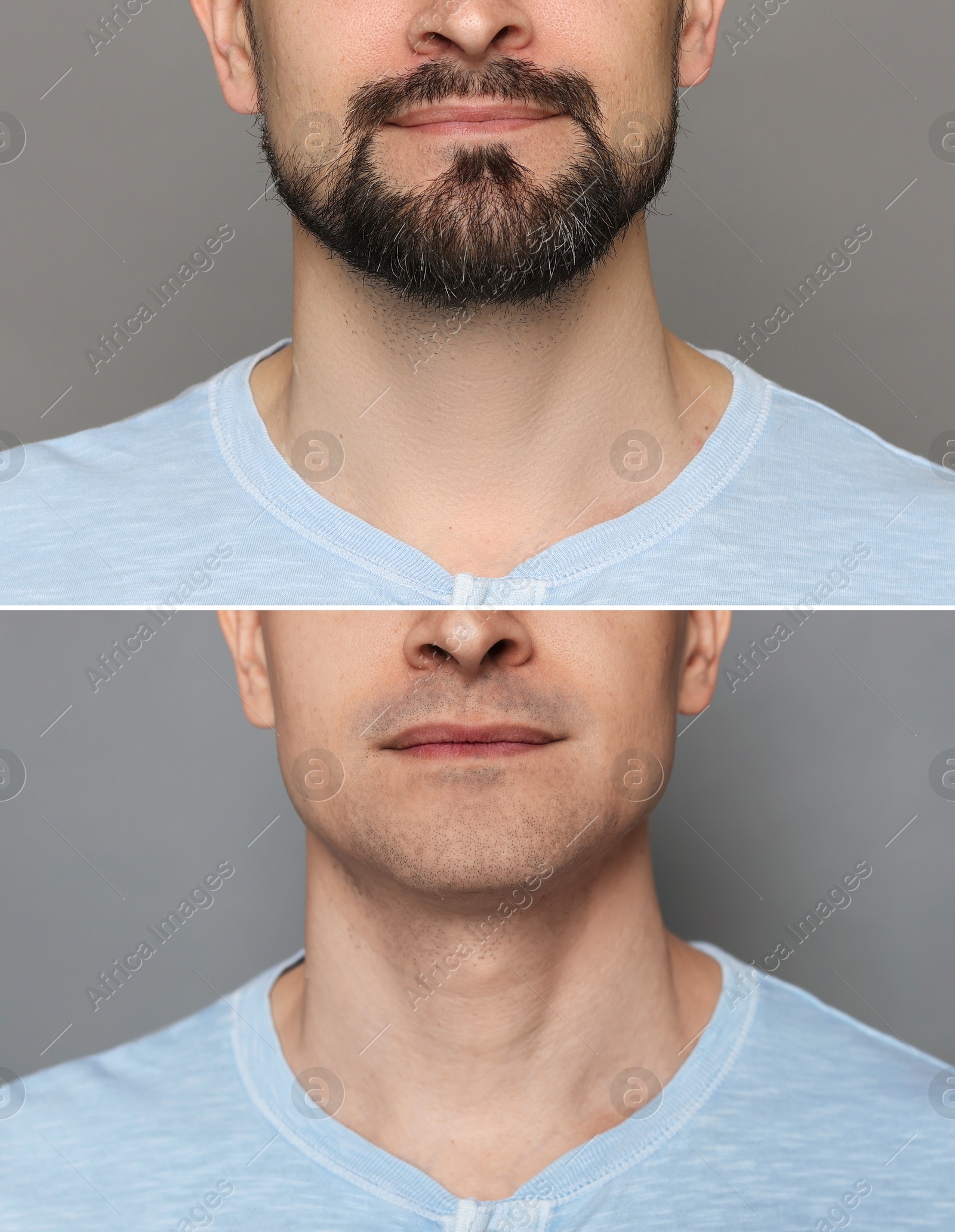 Man before and after shaving on grey background, closeup. Collage of photos Image of Man before and after shaving on grey background, closeup. Collage of photos