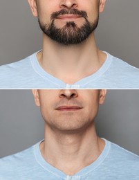 Image of Man before and after shaving on grey background, closeup. Collage of photos