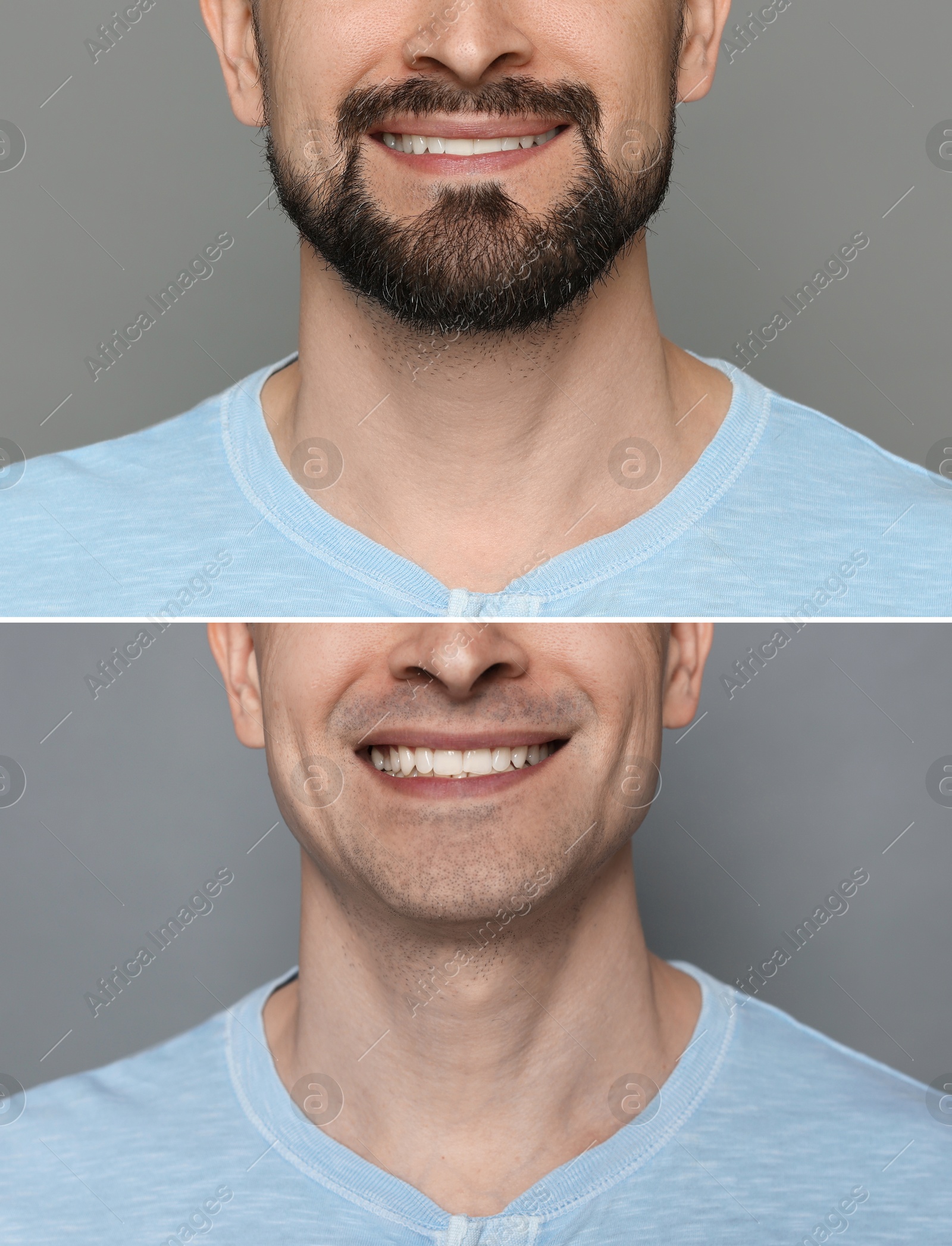 Man before and after shaving on grey background, closeup. Collage of photos Image of Man before and after shaving on grey background, closeup. Collage of photos