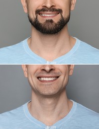 Image of Man before and after shaving on grey background, closeup. Collage of photos