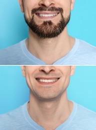 Image of Man before and after shaving on light blue background, closeup. Collage of photos