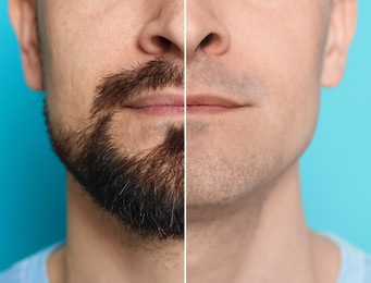 Image of Man before and after shaving on light blue background, closeup. Collage of photos