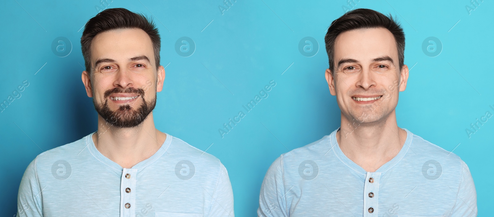Handsome man before and after shaving on light blue background, collage of photos. Banner design Image of Handsome man before and after shaving on light blue background, collage of photos. Banner design