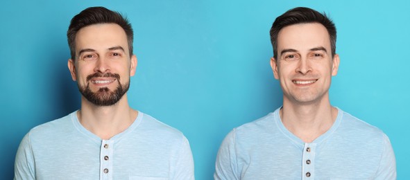 Image of Handsome man before and after shaving on light blue background, collage of photos. Banner design
