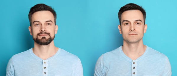 Image of Handsome man before and after shaving on light blue background, collage of photos. Banner design