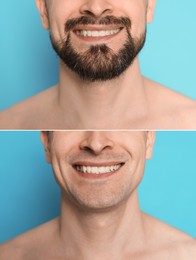 Image of Man before and after shaving on light blue background, closeup. Collage of photos