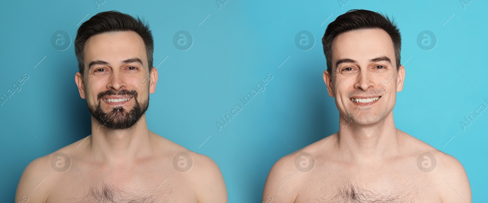 Handsome man before and after shaving on light blue background, collage of photos. Banner design Image of Handsome man before and after shaving on light blue background, collage of photos. Banner design