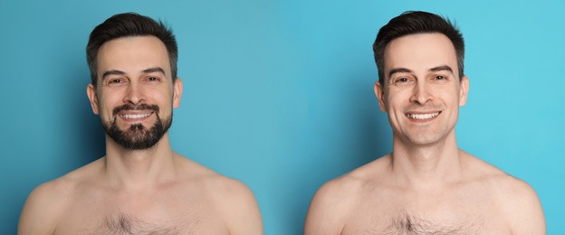 Image of Handsome man before and after shaving on light blue background, collage of photos. Banner design